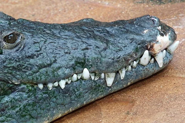 Invisalign