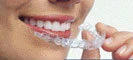 Orthodontics for General Practitioners